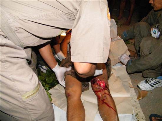 2010_10080115 (Custom)