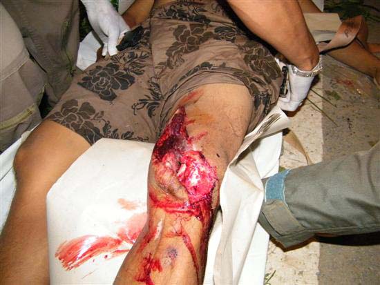 2010_10080117 (Custom)