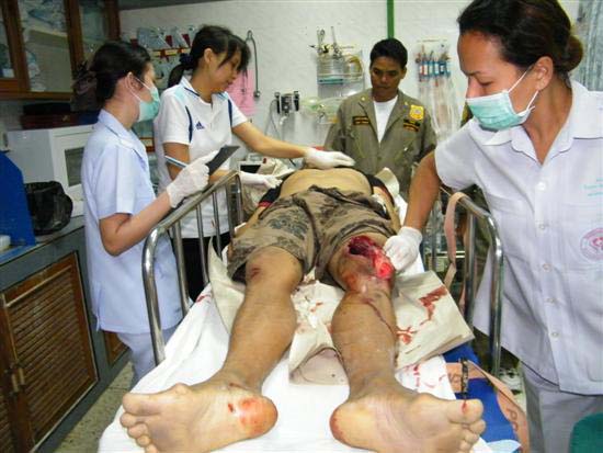 2010_10080147 (Custom)