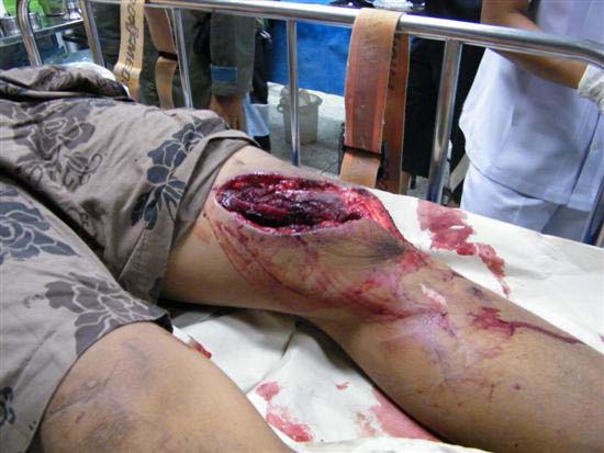 2010_10080149 (Custom)