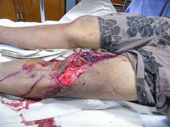 2010_10080153 (Custom)