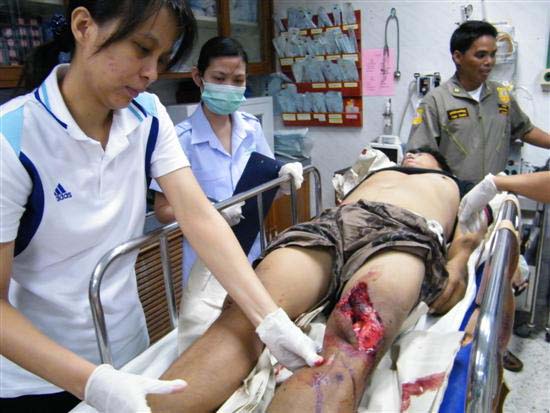 2010_10080160 (Custom)